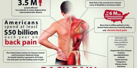 Lower Back Pain - Everything You Want to Know