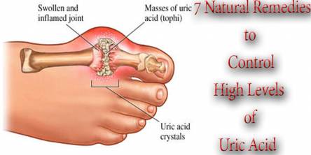 7 Natural Remedies to Control High Levels of Uric Acid
